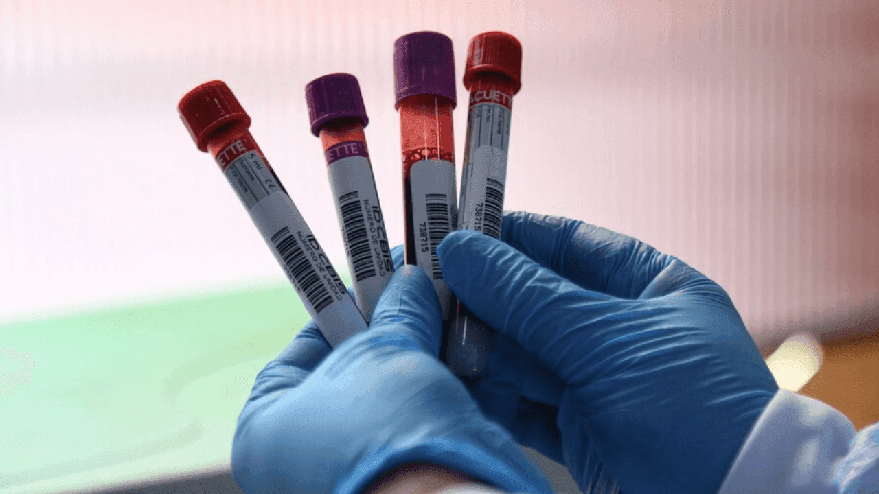 Alerta por reservas críticas de sangre en Colombia: demanda de O+ supera la capacidad de reposición