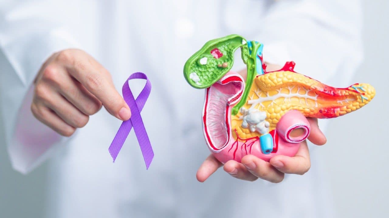 cancer de pancreas  foto