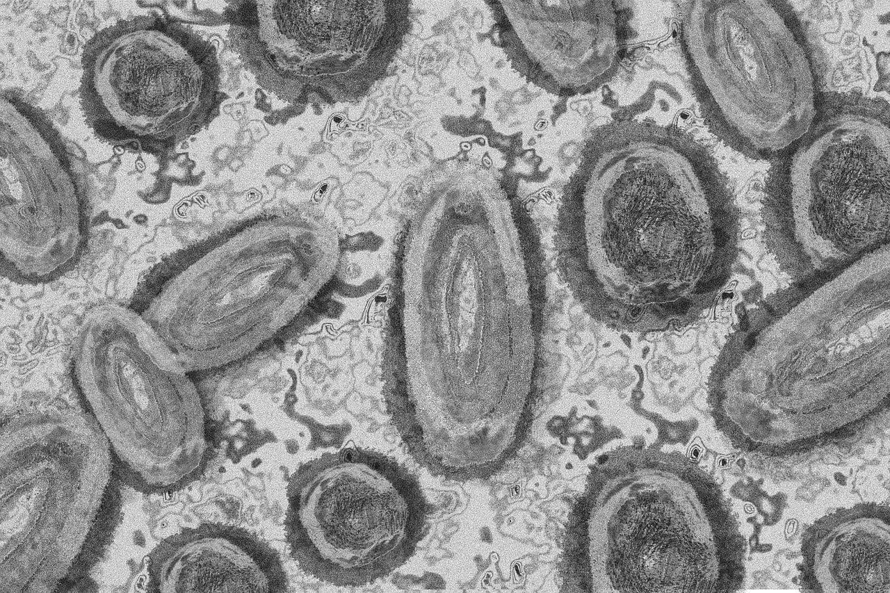 photologuephotos2023-02monkey-pox-gd59d6dd87_1280jpg