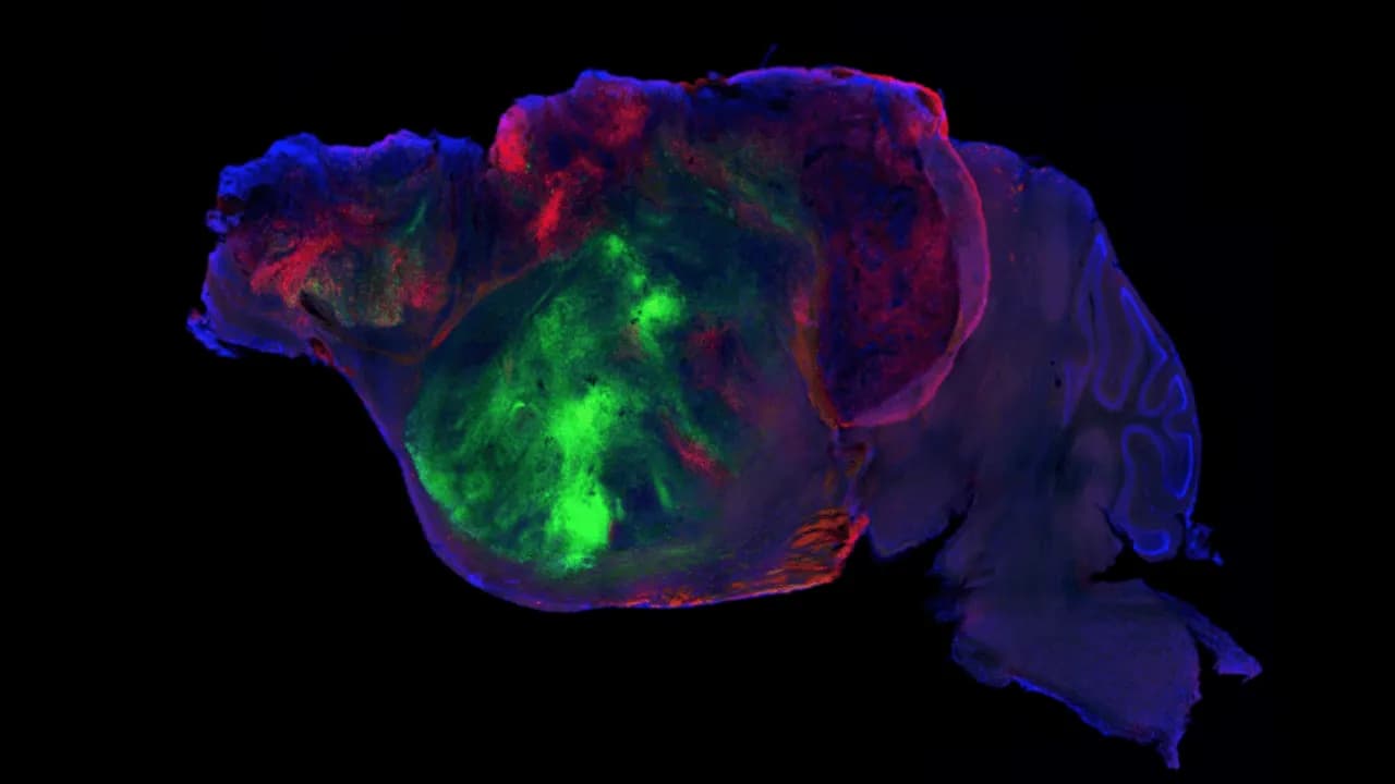 Cerebros quiméricos: cuando un ratón funciona con neuronas humanas