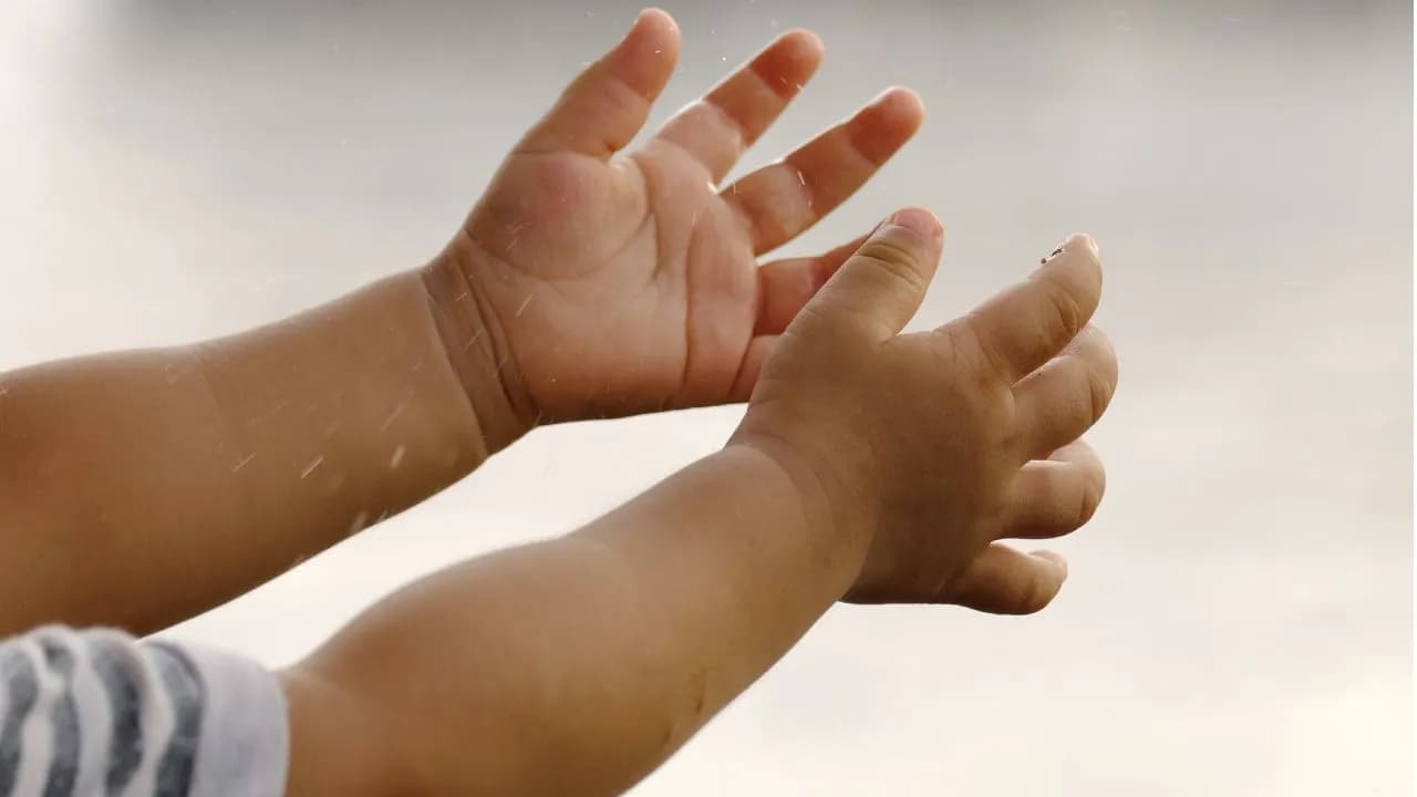 La CIDH exige garantizar el tratamiento de Elián, el bebé indígena con piel de mariposa en Guainía La CIDH exige garantizar el tratamiento de Elián, el bebé indígena con piel de mariposa en Guainía