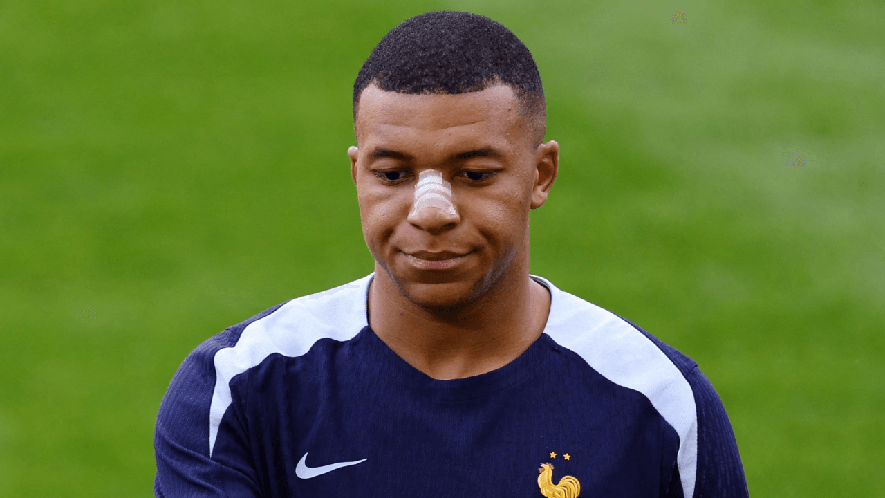 photologuephotos2024-06mbappe_con_su_fractura_de_nariz_y_la_venda_que_hace_parte_del_entrenamiento_0png