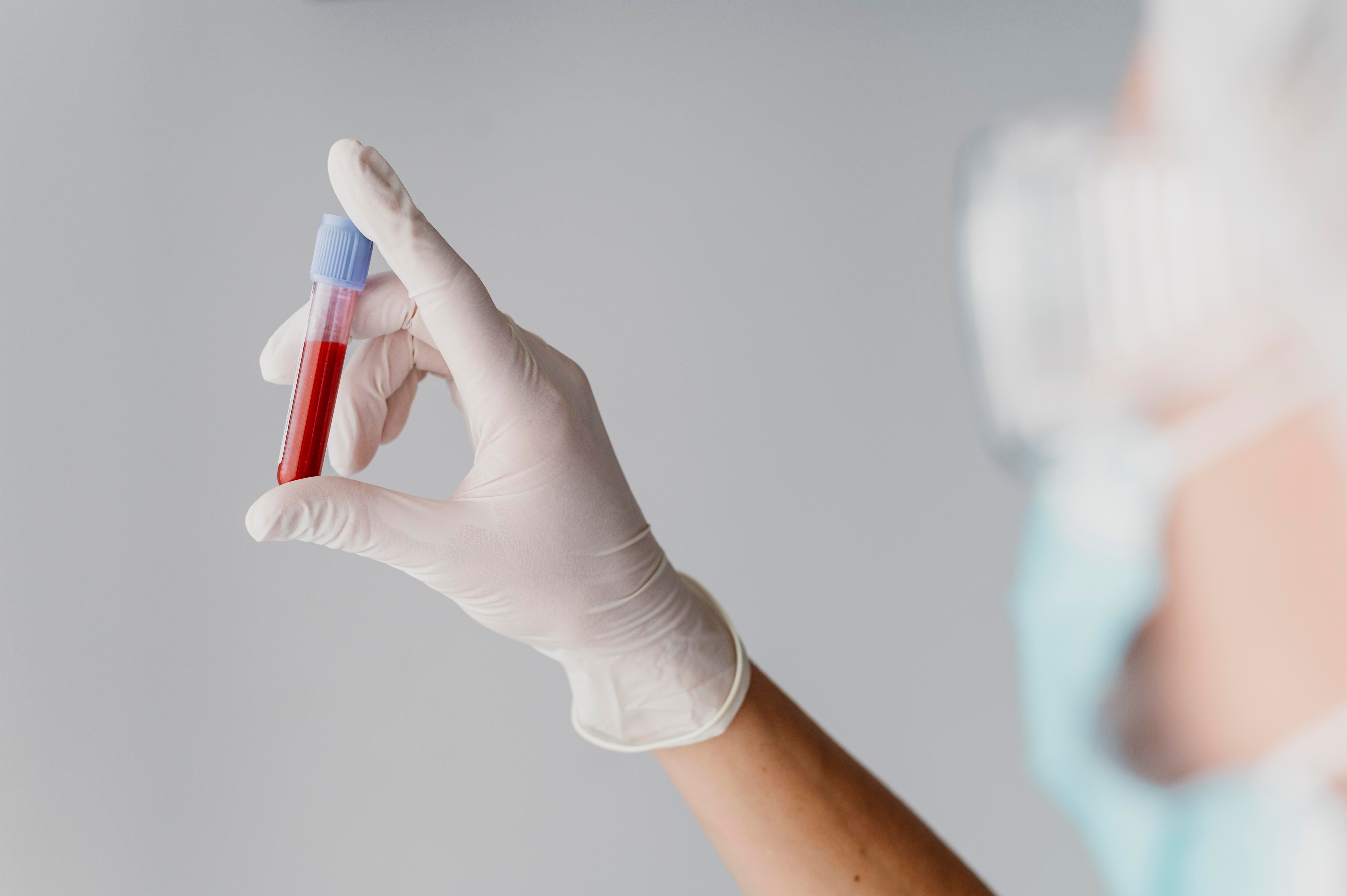 back-view-doctor-holding-blood-sample.jpg