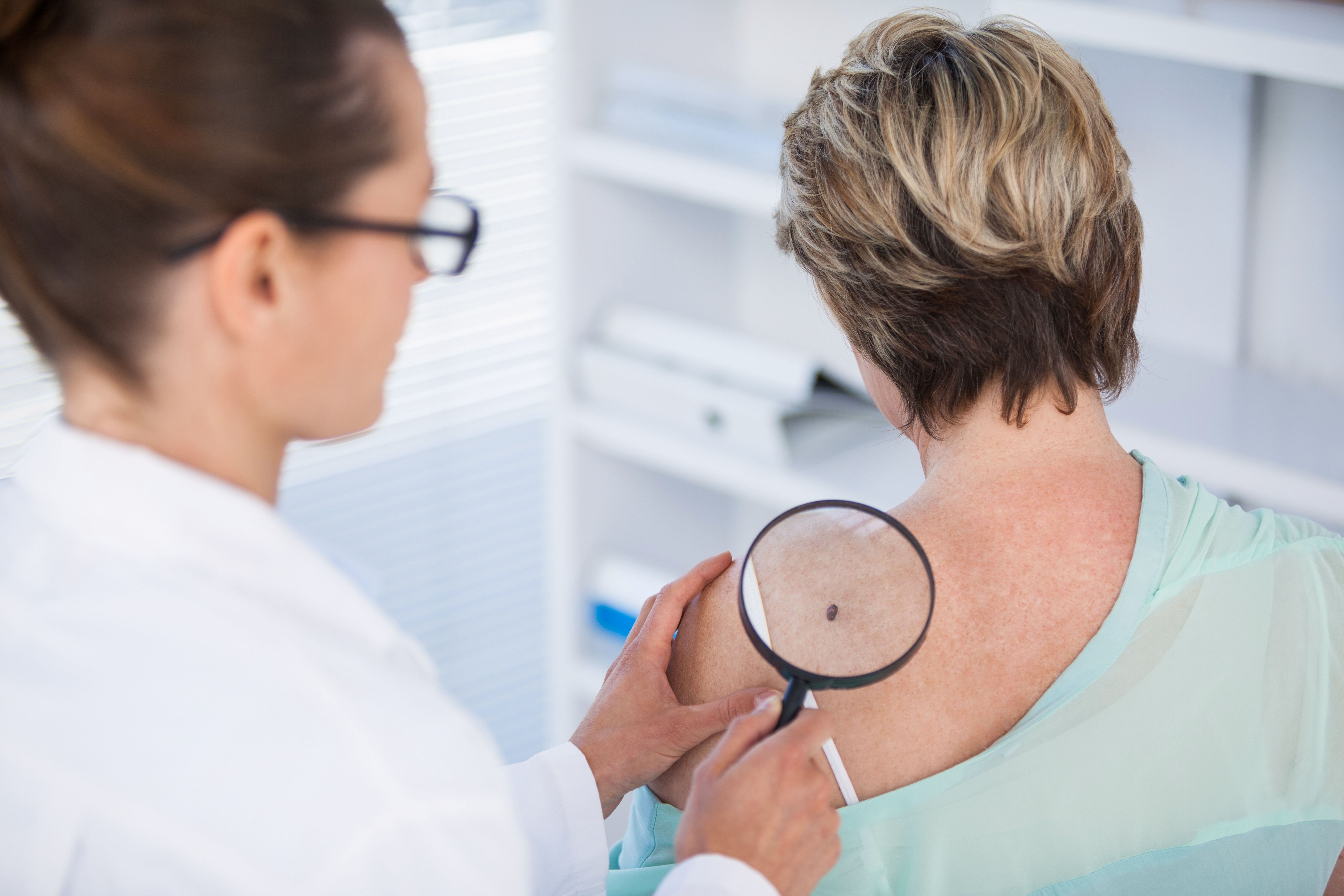 dermatologo-examinando-lunar-de-paciente-con-lupa.jpg