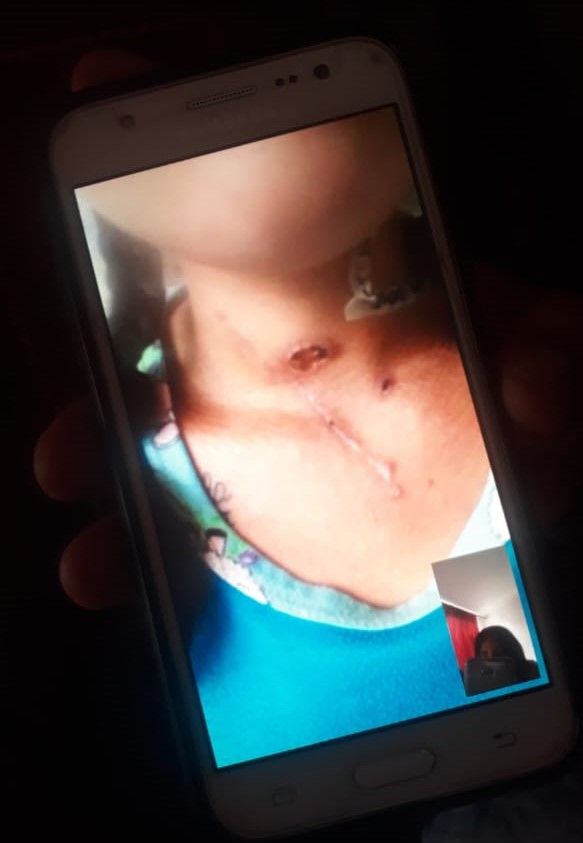Imagen herida en el cuello
