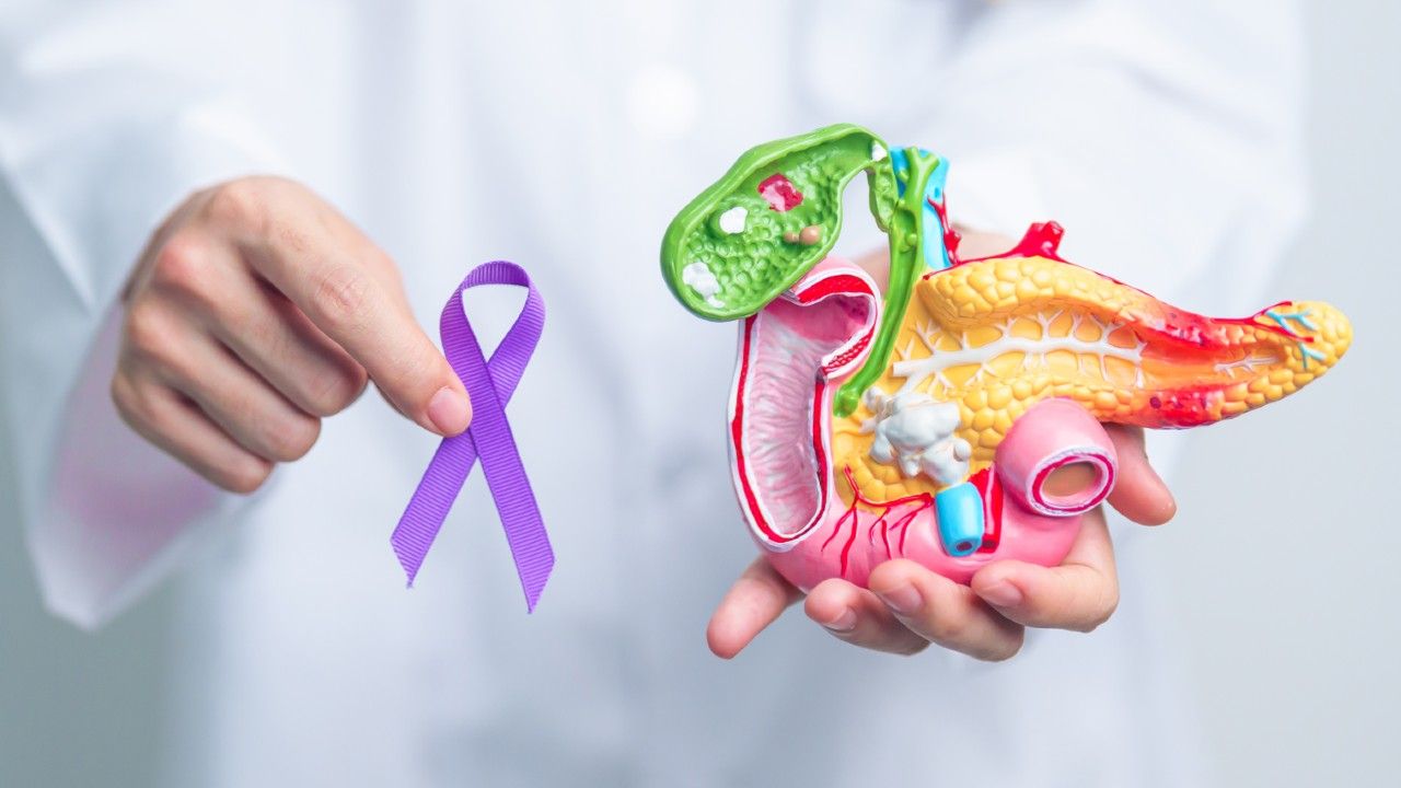 cancer de pancreas foto