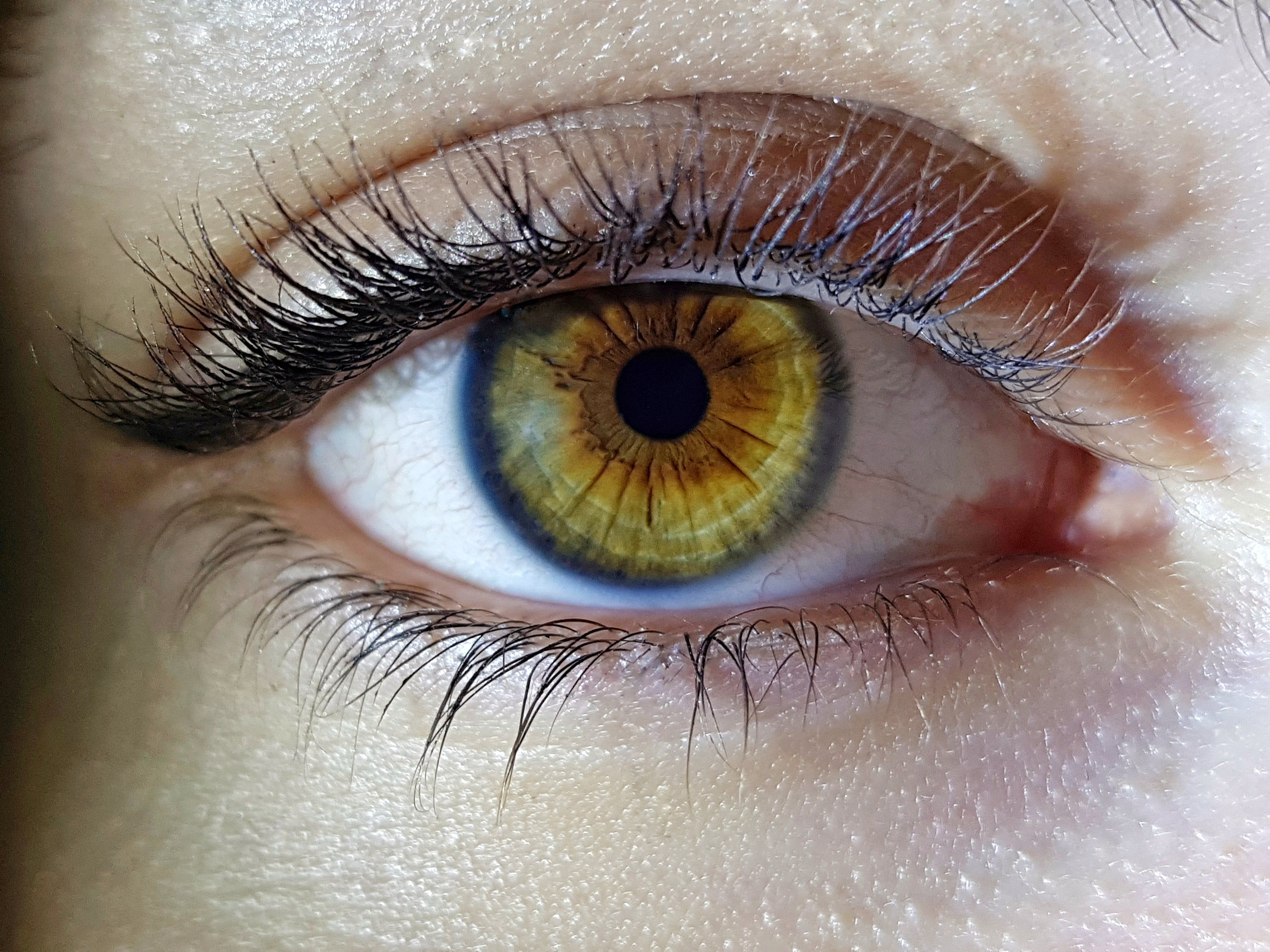 salud visual 4